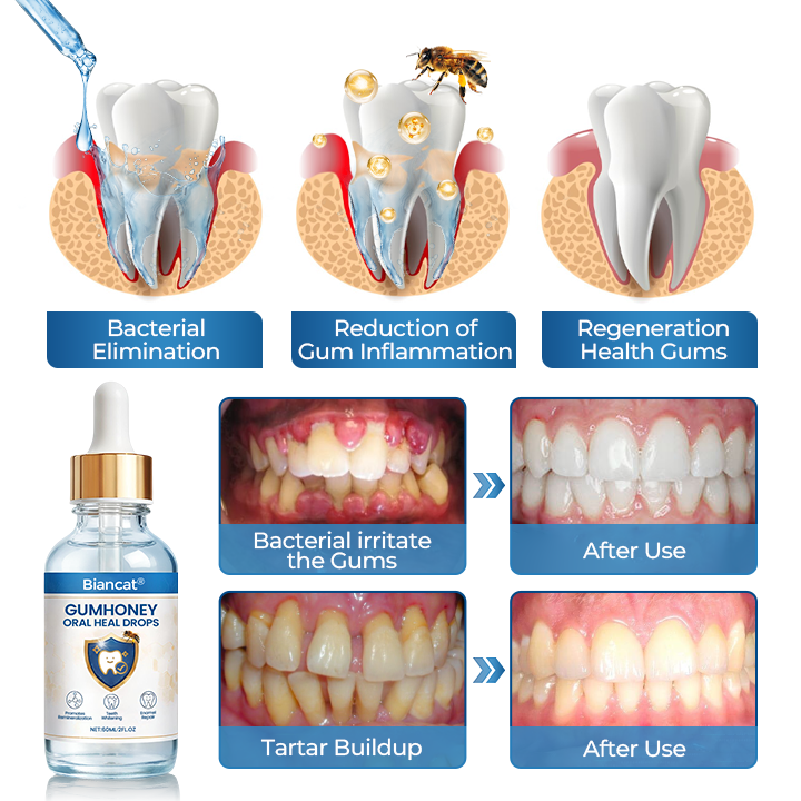 GumHoney Oral Repair Drops