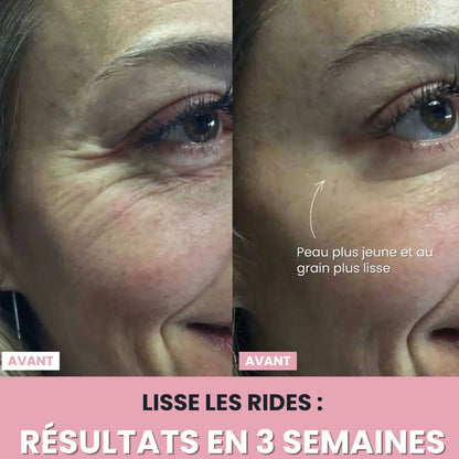 LenaSilk : Sculpteur facial LED 7 en 1