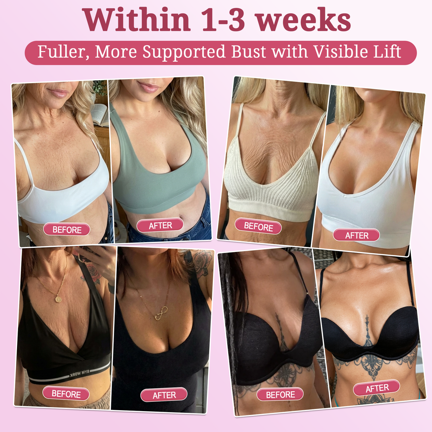 2𝐇𝐈𝐒𝐊𝐈𝐍® 𝐏𝐃𝐑𝐍 𝐏𝐢𝐧𝐤 𝐂𝐨𝐥𝐥𝐚𝐠𝐞𝐧 𝐒𝐭𝐞𝐦𝐋𝐢𝐟𝐭 𝐏𝐥𝐮𝐦𝐩𝐢𝐧𝐠 𝐌𝐮𝐥𝐭𝐢 𝐁𝐚𝐥𝐦 𝐟𝐨𝐫 𝐔𝐧𝐝𝐞𝐫-𝐄𝐲𝐞𝐬, 𝐍𝐞𝐜𝐤, 𝐅𝐨𝐫𝐞𝐡𝐞𝐚𝐝, 𝐒𝐦𝐢𝐥𝐞 𝐋𝐢𝐧𝐞𝐬,𝐅𝐢𝐫𝐦𝐢𝐧𝐠, 𝐋𝐢𝐟𝐭𝐢𝐧𝐠, 𝐅𝐮𝐥𝐥𝐞𝐫-𝐋𝐨𝐨𝐤𝐢𝐧𝐠 𝐂𝐮𝐫𝐯𝐞𝐬 & 𝐒𝐤𝐢𝐧 𝐂𝐨𝐦𝐟𝐨𝐫𝐭