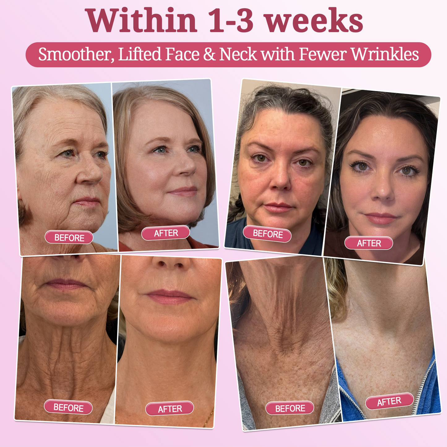 2𝐇𝐈𝐒𝐊𝐈𝐍® 𝐏𝐃𝐑𝐍 𝐏𝐢𝐧𝐤 𝐂𝐨𝐥𝐥𝐚𝐠𝐞𝐧 𝐒𝐭𝐞𝐦𝐋𝐢𝐟𝐭 𝐏𝐥𝐮𝐦𝐩𝐢𝐧𝐠 𝐌𝐮𝐥𝐭𝐢 𝐁𝐚𝐥𝐦 𝐟𝐨𝐫 𝐔𝐧𝐝𝐞𝐫-𝐄𝐲𝐞𝐬, 𝐍𝐞𝐜𝐤, 𝐅𝐨𝐫𝐞𝐡𝐞𝐚𝐝, 𝐒𝐦𝐢𝐥𝐞 𝐋𝐢𝐧𝐞𝐬,𝐅𝐢𝐫𝐦𝐢𝐧𝐠, 𝐋𝐢𝐟𝐭𝐢𝐧𝐠, 𝐅𝐮𝐥𝐥𝐞𝐫-𝐋𝐨𝐨𝐤𝐢𝐧𝐠 𝐂𝐮𝐫𝐯𝐞𝐬 & 𝐒𝐤𝐢𝐧 𝐂𝐨𝐦𝐟𝐨𝐫𝐭