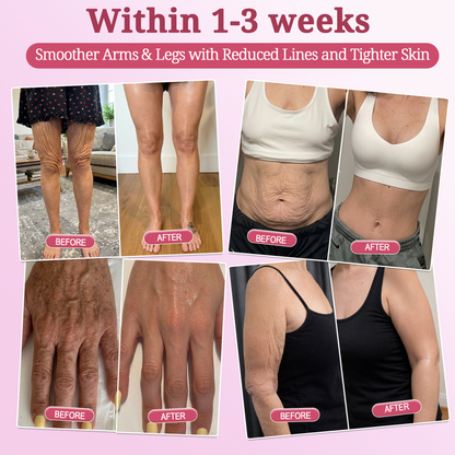 2𝐇𝐈𝐒𝐊𝐈𝐍® 𝐏𝐃𝐑𝐍 𝐏𝐢𝐧𝐤 𝐂𝐨𝐥𝐥𝐚𝐠𝐞𝐧 𝐒𝐭𝐞𝐦𝐋𝐢𝐟𝐭 𝐏𝐥𝐮𝐦𝐩𝐢𝐧𝐠 𝐌𝐮𝐥𝐭𝐢 𝐁𝐚𝐥𝐦 𝐟𝐨𝐫 𝐔𝐧𝐝𝐞𝐫-𝐄𝐲𝐞𝐬, 𝐍𝐞𝐜𝐤, 𝐅𝐨𝐫𝐞𝐡𝐞𝐚𝐝, 𝐒𝐦𝐢𝐥𝐞 𝐋𝐢𝐧𝐞𝐬,𝐅𝐢𝐫𝐦𝐢𝐧𝐠, 𝐋𝐢𝐟𝐭𝐢𝐧𝐠, 𝐅𝐮𝐥𝐥𝐞𝐫-𝐋𝐨𝐨𝐤𝐢𝐧𝐠 𝐂𝐮𝐫𝐯𝐞𝐬 & 𝐒𝐤𝐢𝐧 𝐂𝐨𝐦𝐟𝐨𝐫𝐭