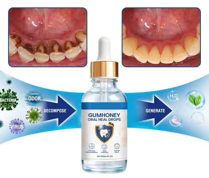 GumHoney Oral Repair Drops