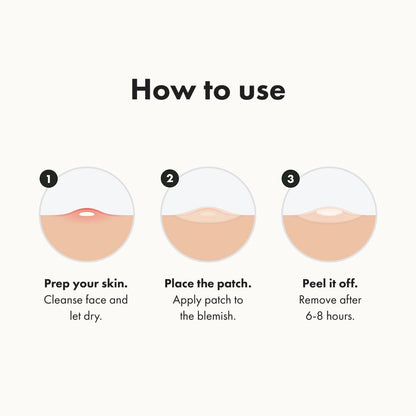 Hero Cosmetics - #1 Hydrocolloid Acne Pimple Patches for Face, Shrinking Zits & Whiteheads in 1 Use, Nighttime Spot Pimple Stickers for Face