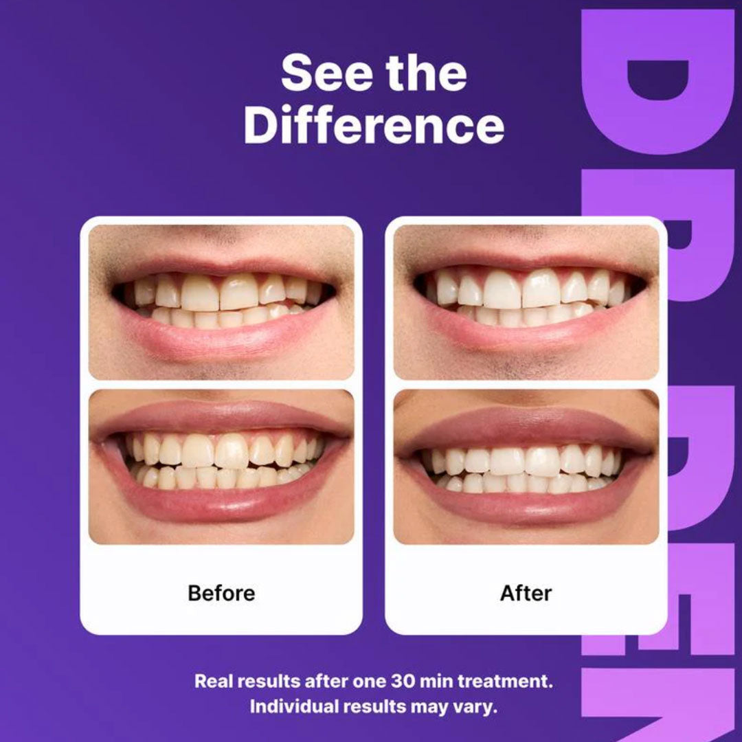 Dr. Dent Purple Teeth Whitening Strips - Fast Results, Zero Sensitivity FREE