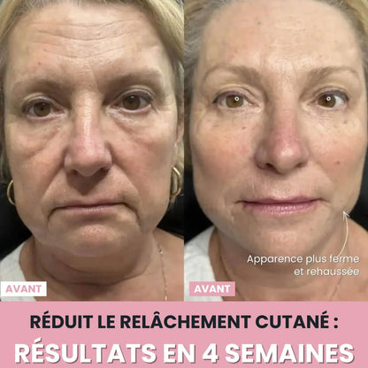 LenaSilk : Sculpteur facial LED 7 en 1