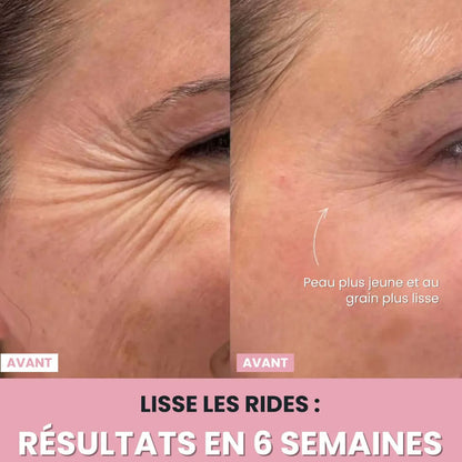 LenaSilk : Sculpteur facial LED 7 en 1