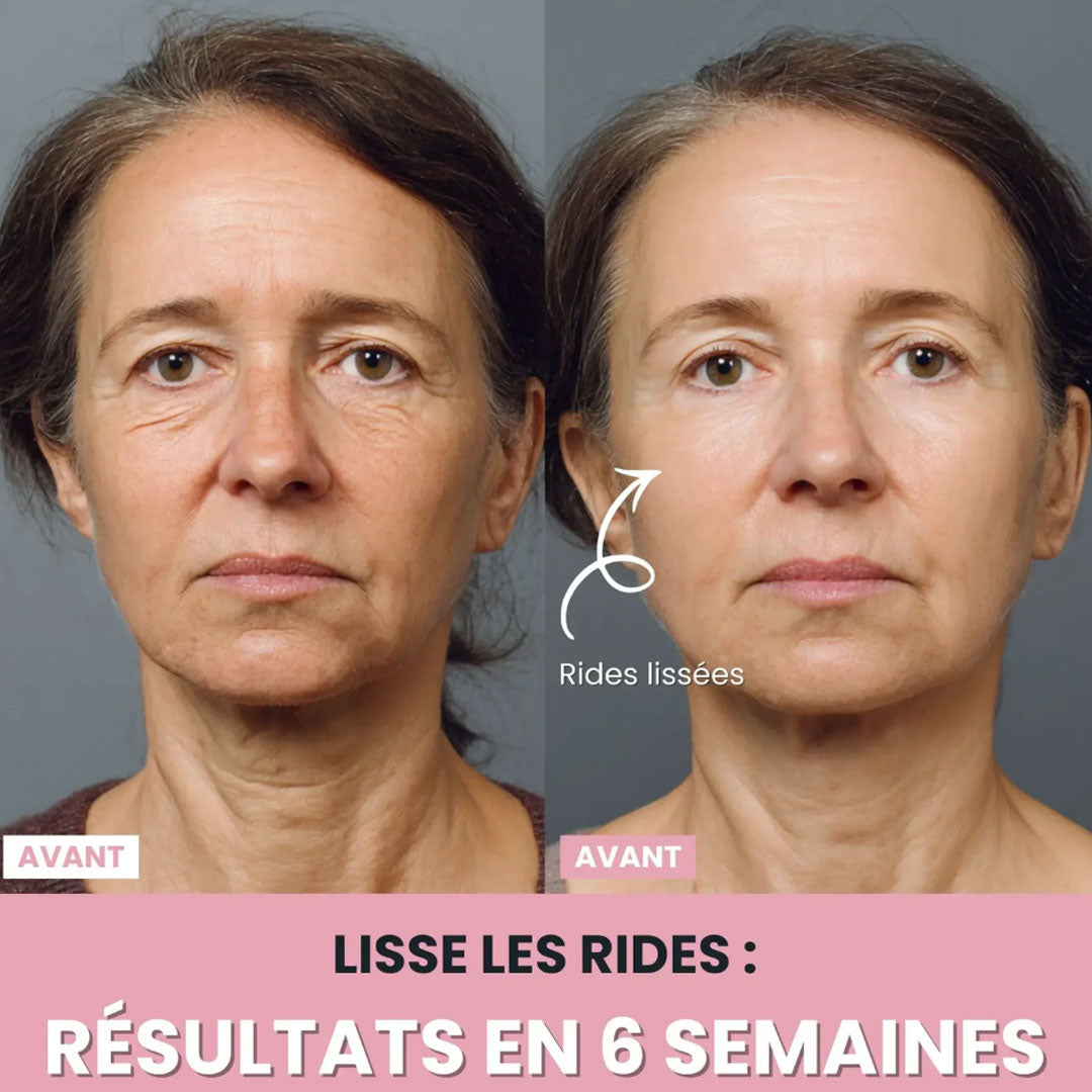 LenaSilk : Sculpteur facial LED 7 en 1